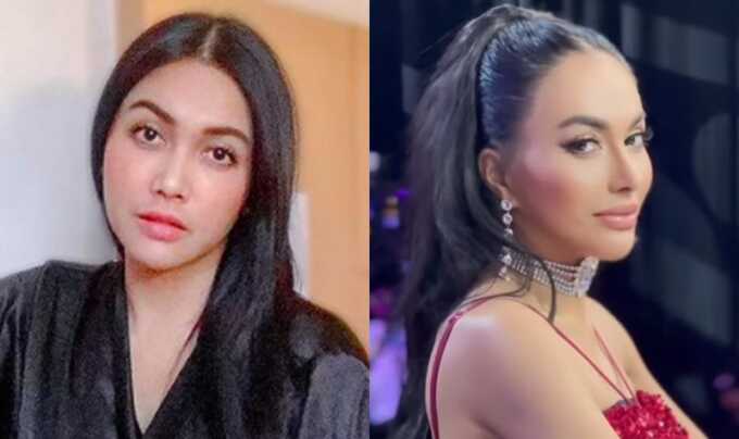 Denada sebelum operasi (kiri), Denada setelah operasi (kanan).