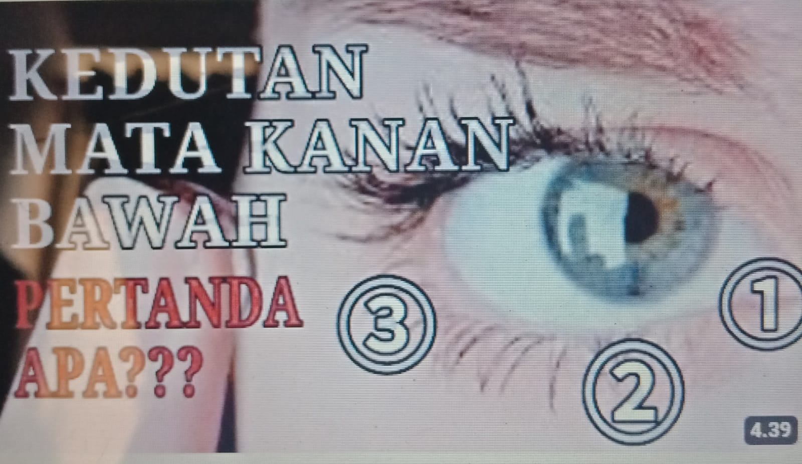 ilustrasi - arti kedutan mata kanan bawah