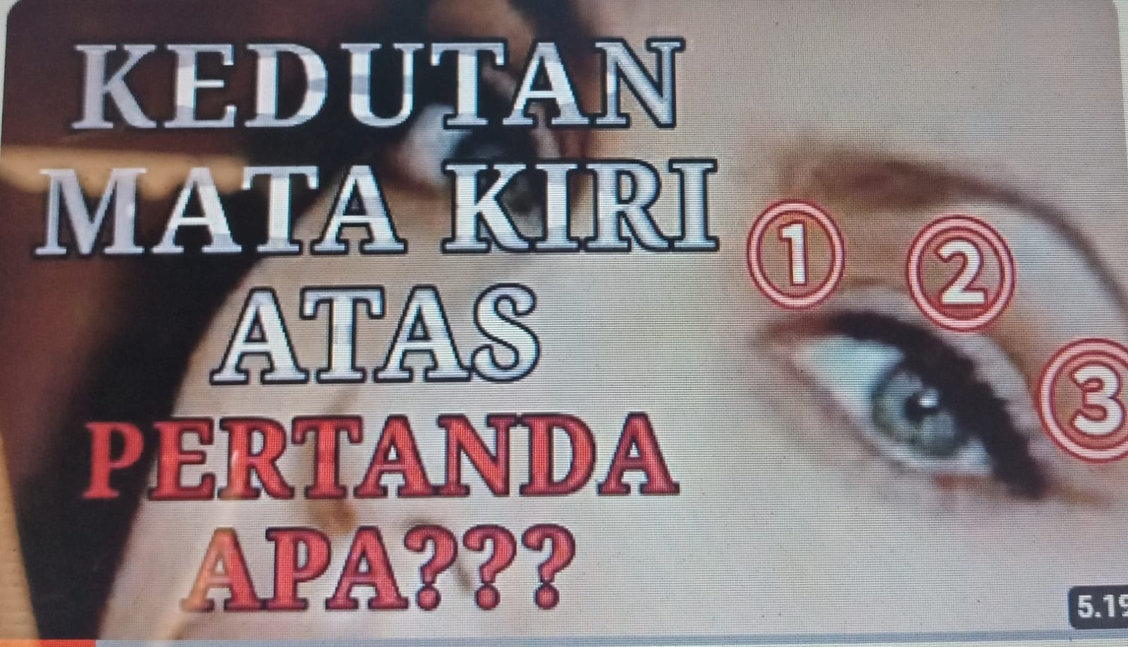 ilustrasi - arti kedutan mata kiri atas