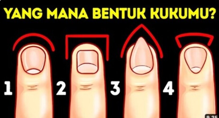 Ilustrasi - Bentuk kuku