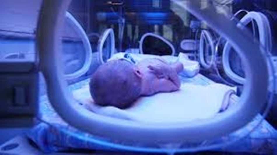 Bayi dalam incubator (Ilustrasi)