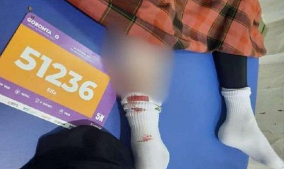 Peserta GHM saat menjalani perawatan di Rumah sakit usai jatuh dalam trotoar berlubang  (F :istimewa)