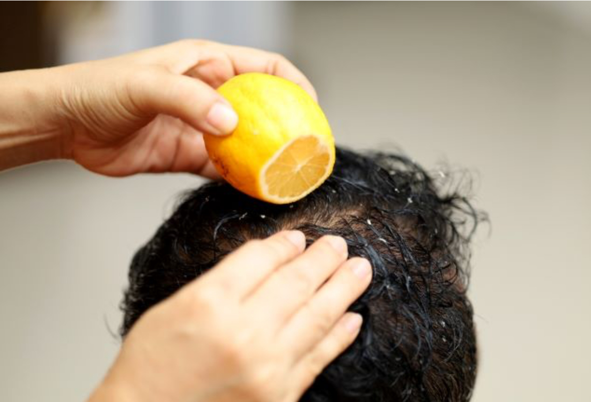 Ilustrasi: lemon untuk Kesehatan rambut