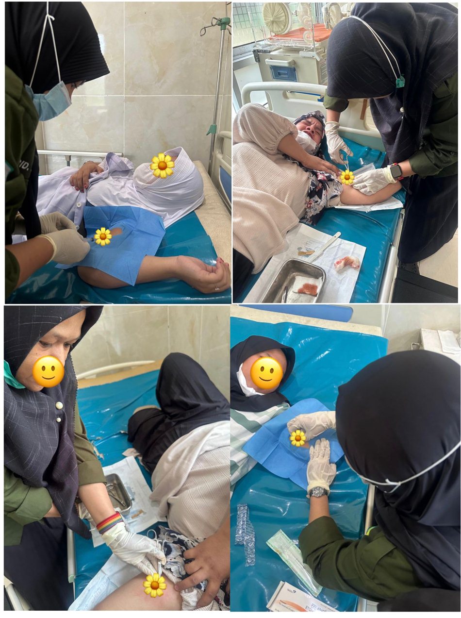 Puskesmas Paguyaman Gencarkan Layanan KB untuk Pasangan Usia Subur.(F: H umas)