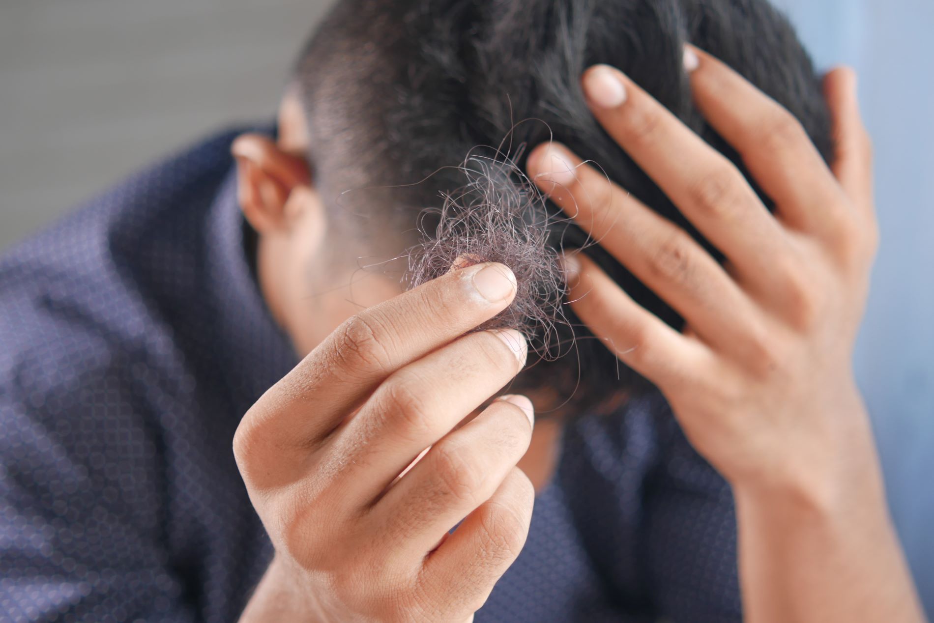 ilustrasi orang stress berefek ke rambut