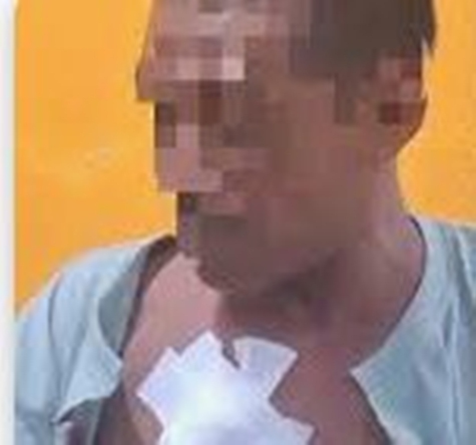 Korban pana wayer saat menjalani perawatan   di Rumah Sakit.(F:ist)