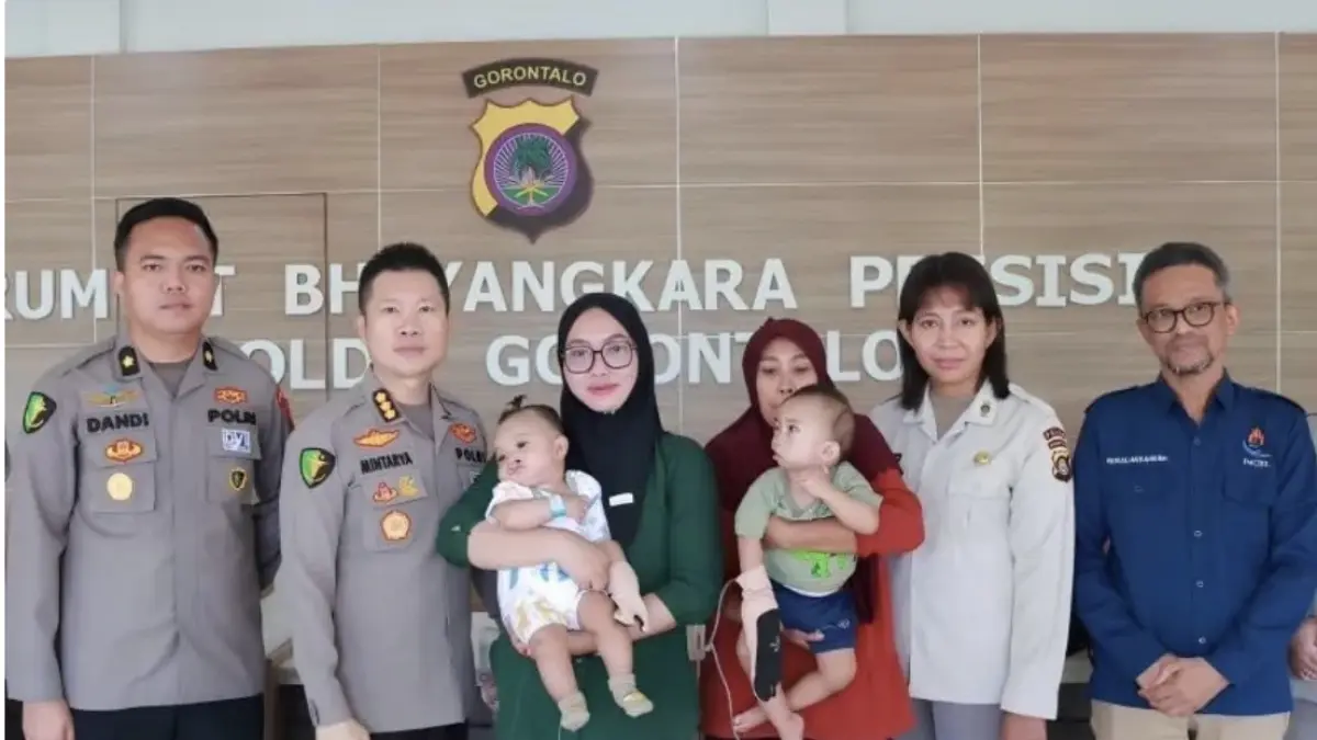 Kabid Dokes Polda Gorontalo Kombespol Mintarya Suryanto (kedua dari kiri) bersama calon pasien pada kegiatan operasi bibir sumbing gratis dalam rangka Hari Bhayangkara ke 80, berlangsung di Rumah Sakit Bhayangkara Polda Gorontalo, Kabupaten Gorontalo, Provinsi Gorontalo, Kamis (18/06/2026). (ANTARA/Polda Gorontalo)
