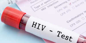 Ilustrasi HIV (Istimewa)