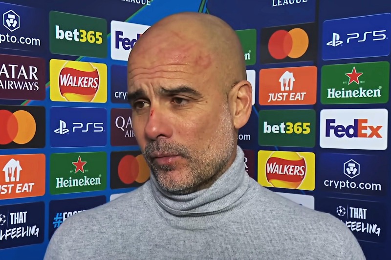 ULAH SENDIRI: Kepala dan hidung Pep Guardiola terlihat mengalami luka setelah City ditahan imbang Feyenoord kemarin (27/11) dini hari WIB.