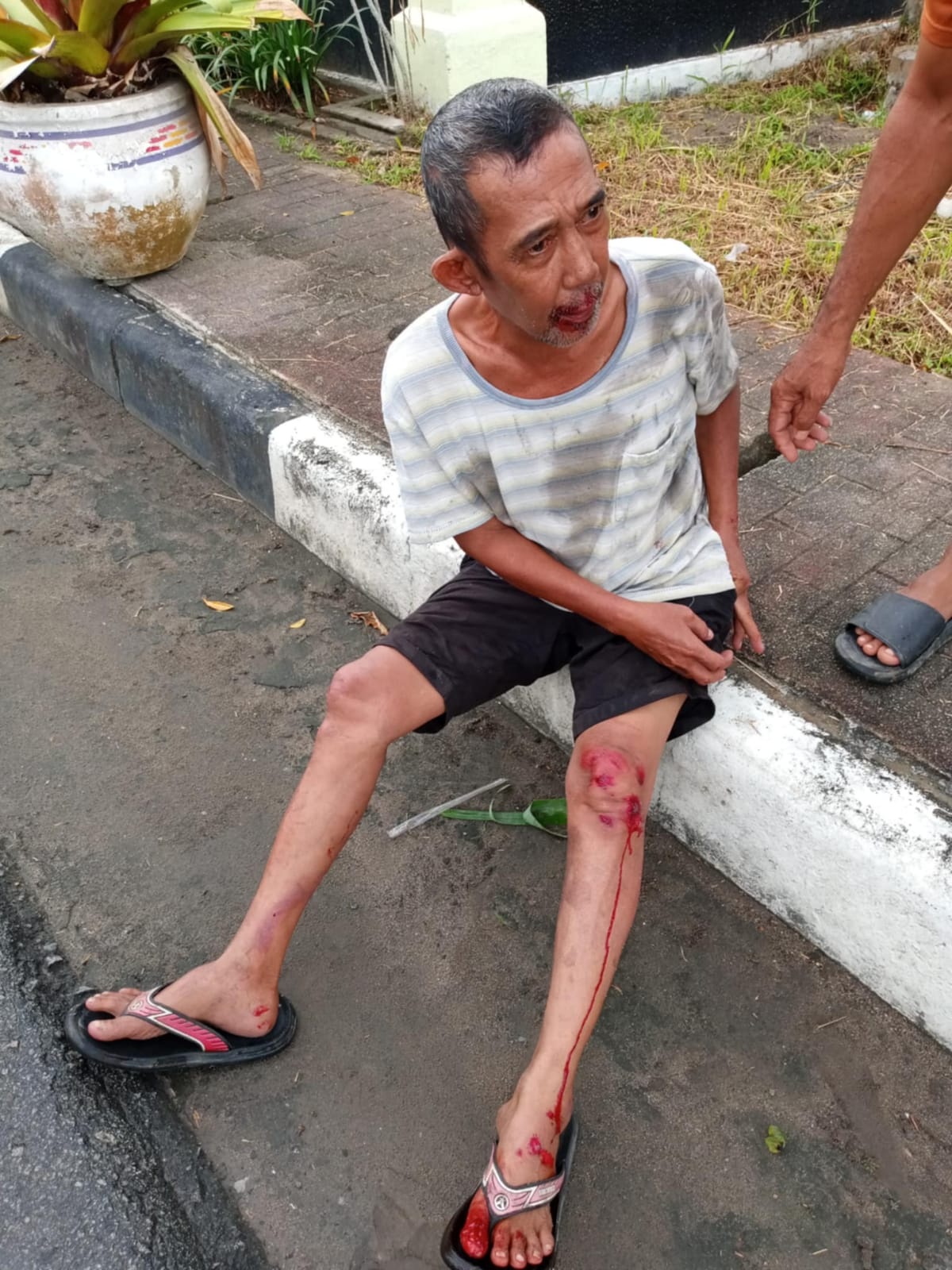 LUKA-LUKA: Seorang warga luka-luka akibat tertimpa pohon di Mempawah, Rabu (3/9).
