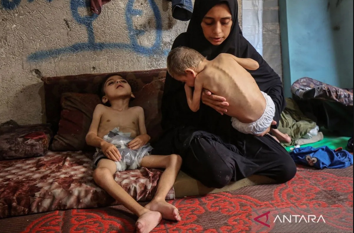 DAMPAK PERANG: Samah Matar bersama dua anaknya, Yousef (6) di gendongan dan Amir (4) yang menderita malnutrisi di pengungsian di Gaza, Palestina, beberapa waktu lalu.