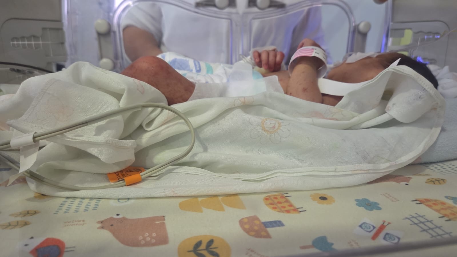 INTENSIF : Bayi yang ditemukan di kebun sawit masih menjalani perawatan intensif di ruang ICU RSUD Agoesdjam Ketapang.
