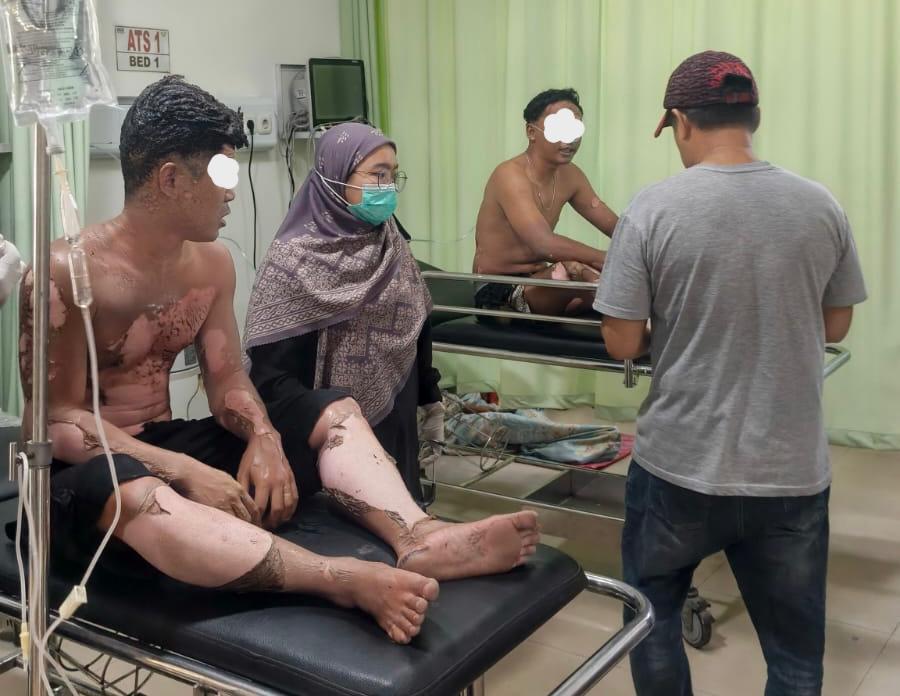 DIRAWAT: Dua korban alami luka bakar saat dirawat di rumah sakit.