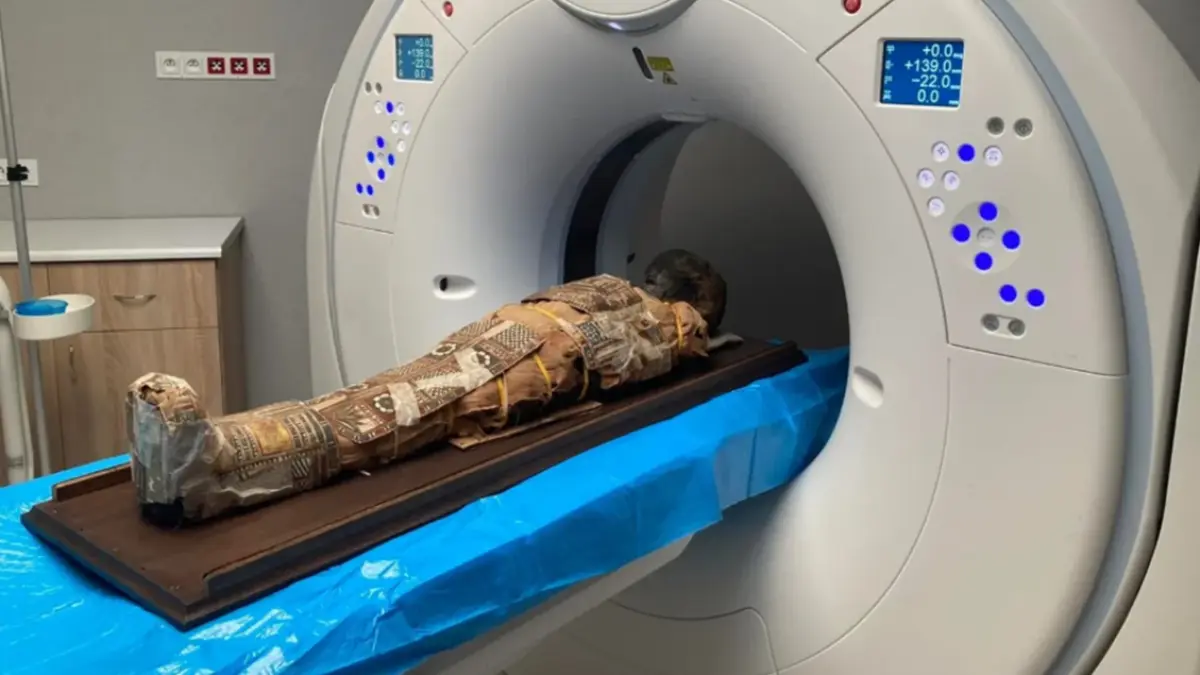 Hasil pemindaian CT mumi anak Mesir yang mengungkap objek misterius di bagian dada.(Marzena Ożarek-Szilke/University of Wrocław)