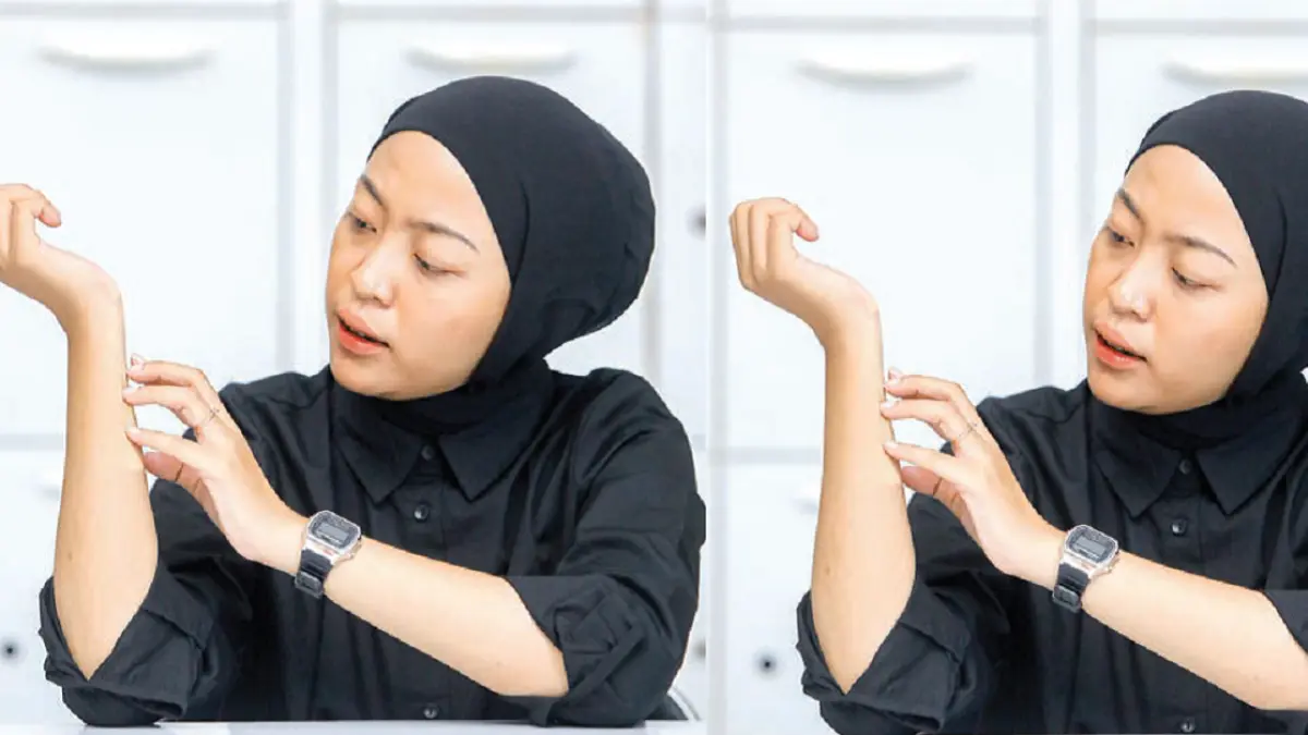 (Model: Meilita Elaine) diilustrasikan mengalami gatal karena alergi. Untuk mengatasinya, bisa minum obat antihistamin sesuai aturan. (DOK JAWAPOS)