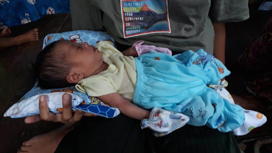 Digendong: Bayi Zakir digedong orang tuanya.Istimewa