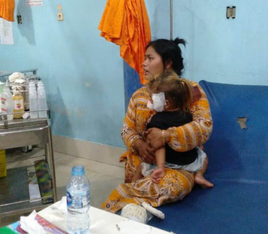 TALI LAYANGAN: Amelia (2), warga RT 08/RW 04, Desa Sungai Rasau, saat mendapatkan penanganan medis, Minggu (25/12). IST