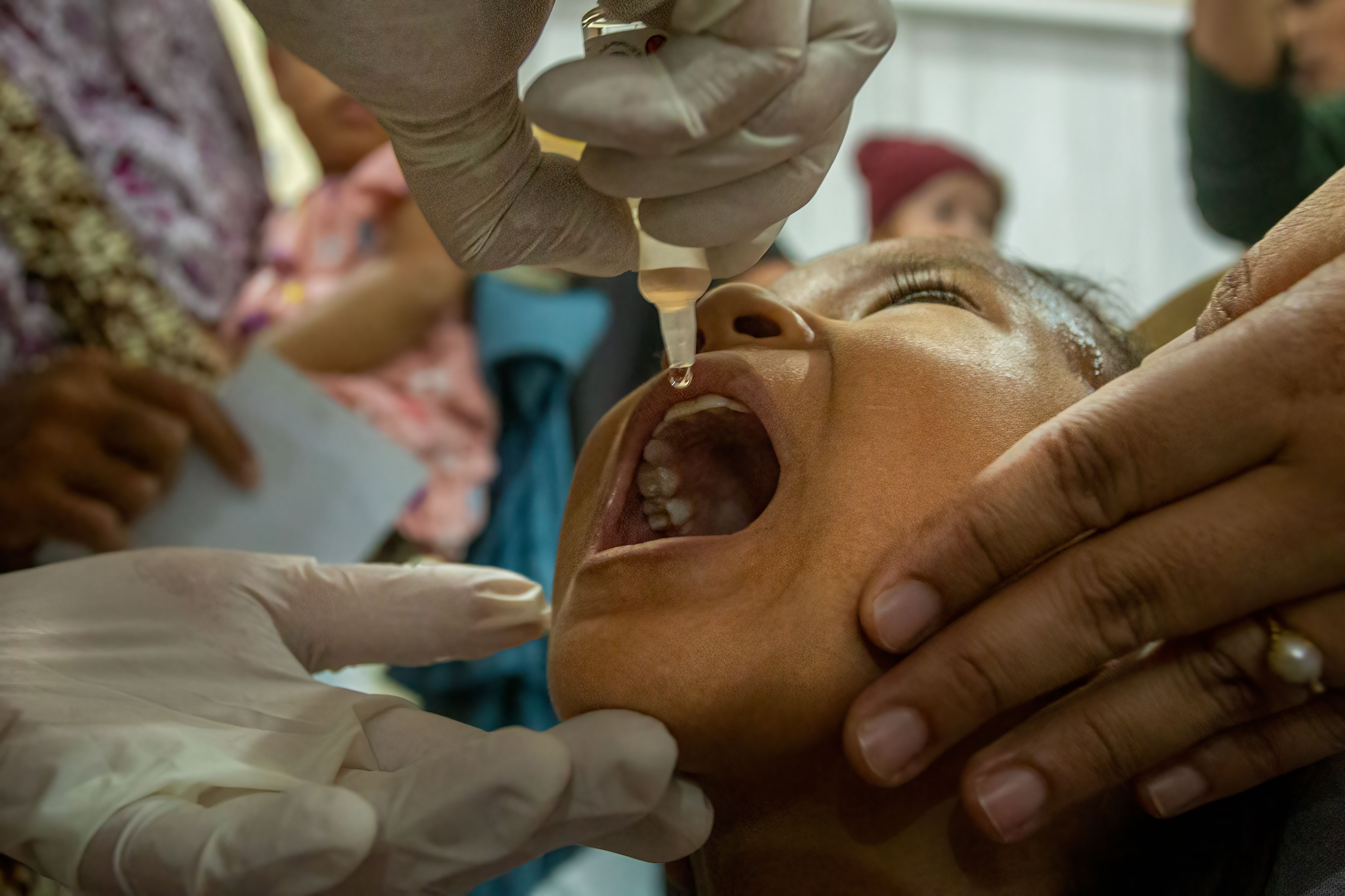 LINDUNGI ANAK: Seorang anak mendapatkan dua tetes imunisasi Polio, di Posyandu Amal Sejati 1, di Mataram, Selasa (23/7). (IVAN/LOMBOK POST )