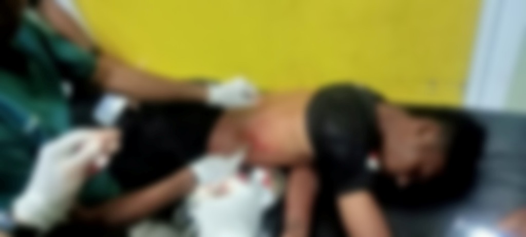 DIRAWAT: Korban mendapat perawatan medis usai dibacok para pelaku, Sabtu (15/2).