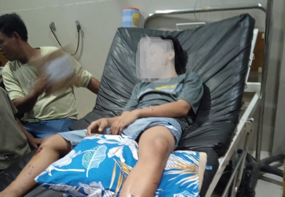 TERKAPAR: Irgi, 23 tahun korban ledakan petasan di Dusun Repok Bunut Desa Jelantik, Kecamatan Jonggat, Lombok Tengah harus mendapat perawatan medis.