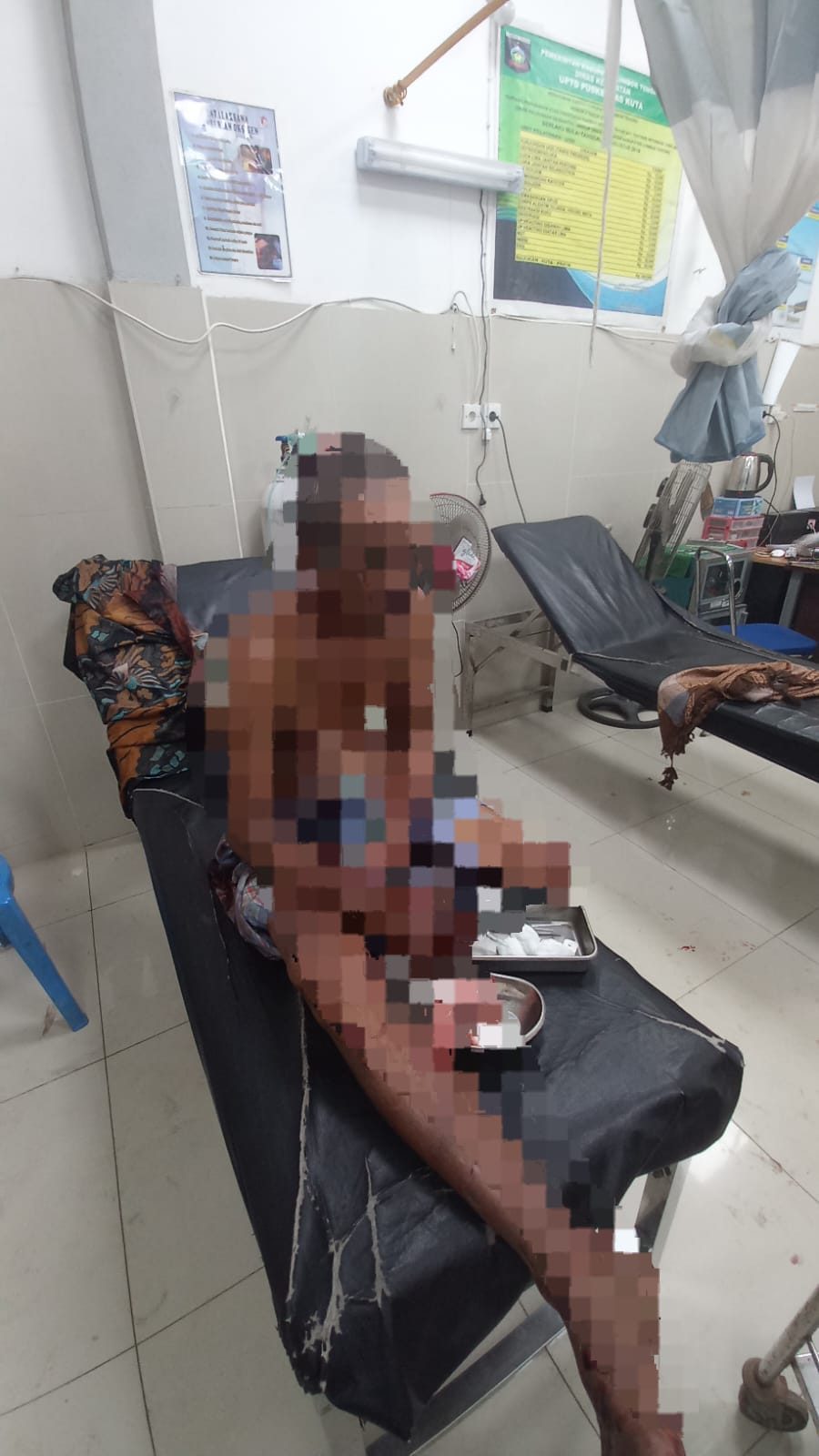 DAPAT PERAWATAN: Alami luka-luka lantaran berkelahi dengan warga, terduga pelaku pencurian hewan ternak dirawat di Puskesmas Pujut, Loteng.