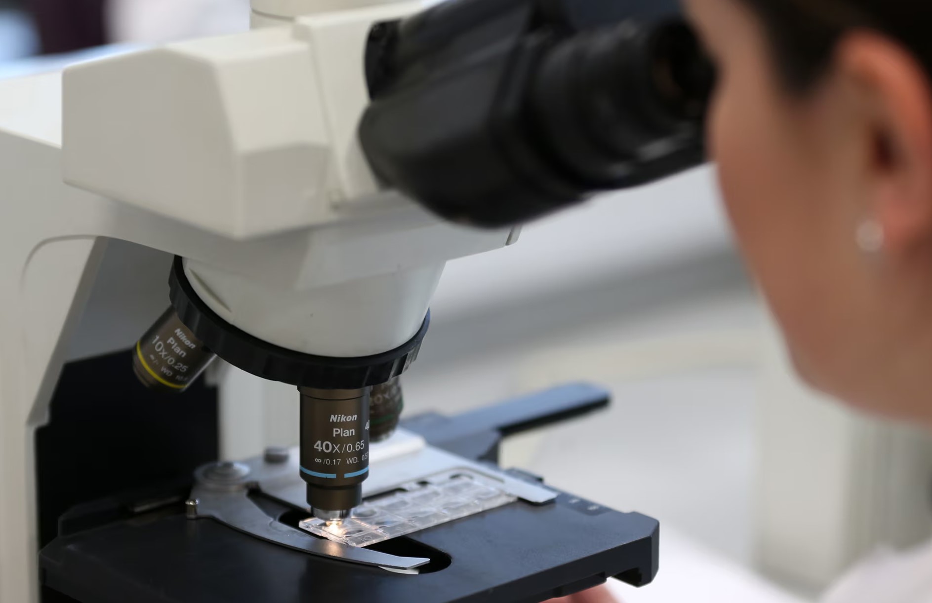 Terobosan baru AI bisa prediksi manfaat obat Abiraterone bagi pasien kanker prostat.