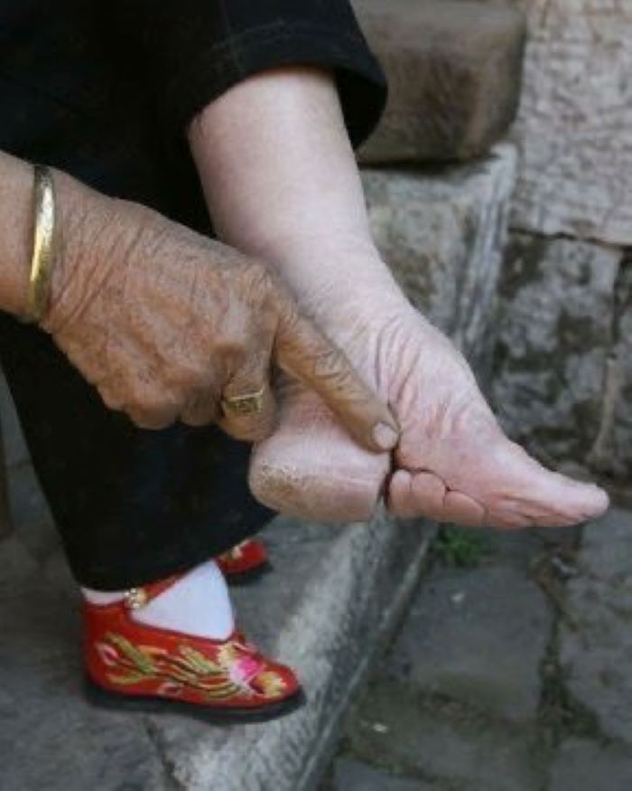 Kaki gadis-gadis muda di Tiongkok diikat erat dalam praktik kuno untuk mencapai "kaki teratai," (internet)