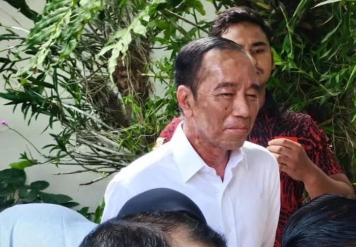 Kondisi kesehatan Jokowi menjadi perhatian publik, dituding alami Sindrom Stevens Johnson.