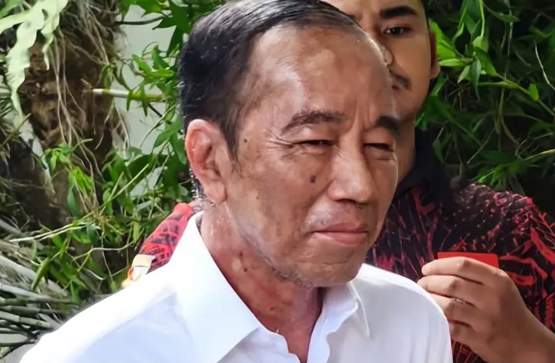 Kondisi terkini wajah mantan presiden Jokowi