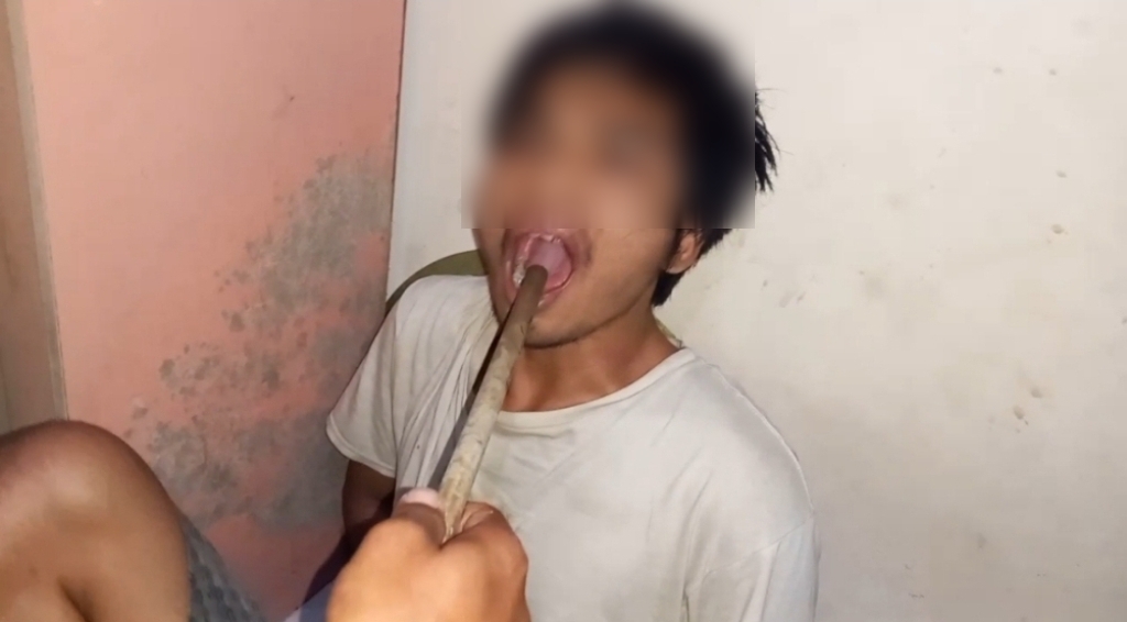 TELAN SABU: Bibir terduga pengedar sabu berinisial BG diperiksa karena telah menelan sabu saat ditangkap polisi, Rabu malam (23/7).&nbsp;