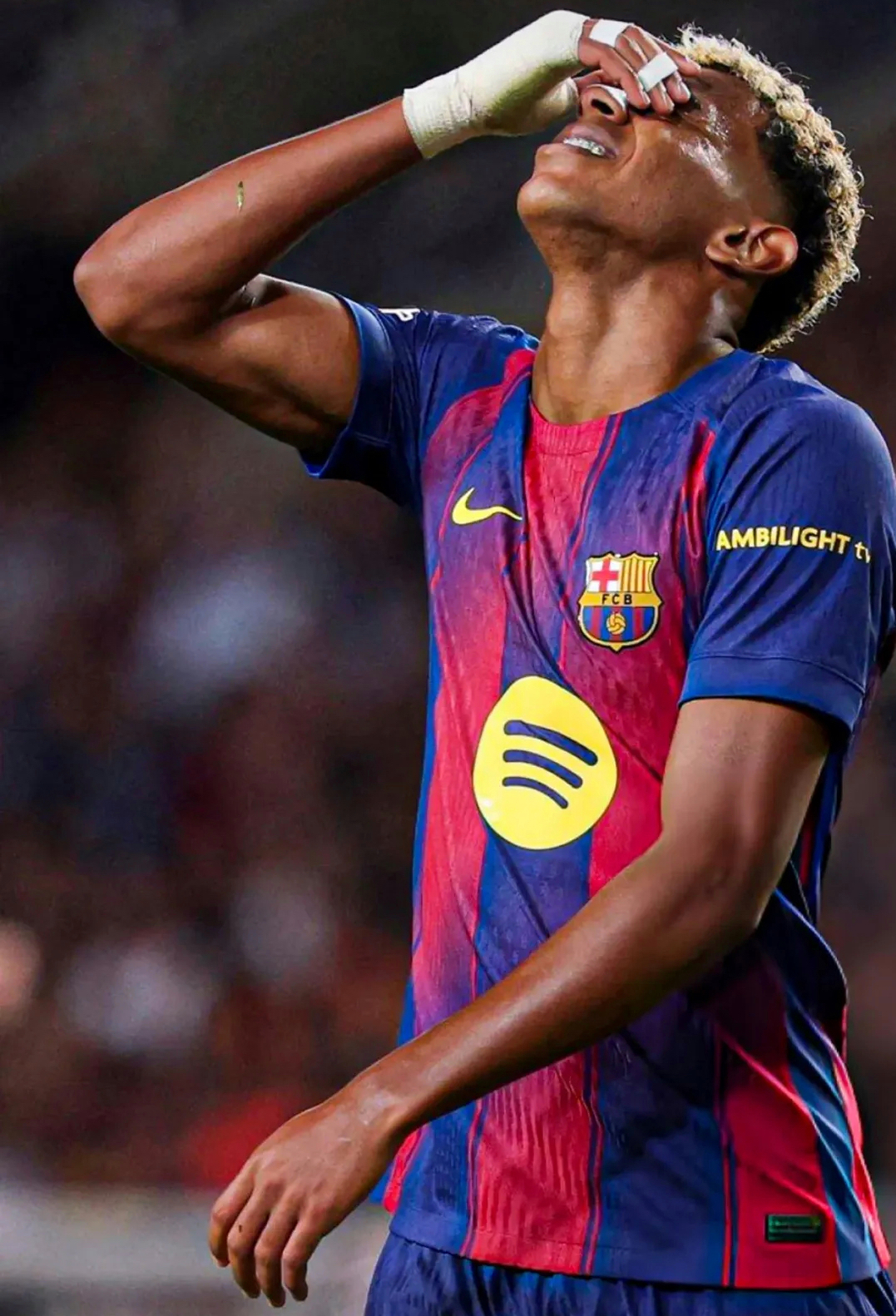 Lamine Yamal alami cedera area sensitif dua kali dalam sebulan. Barcelona siapkan masa pemulihan 2-3 minggu untuk bintang mudanya.