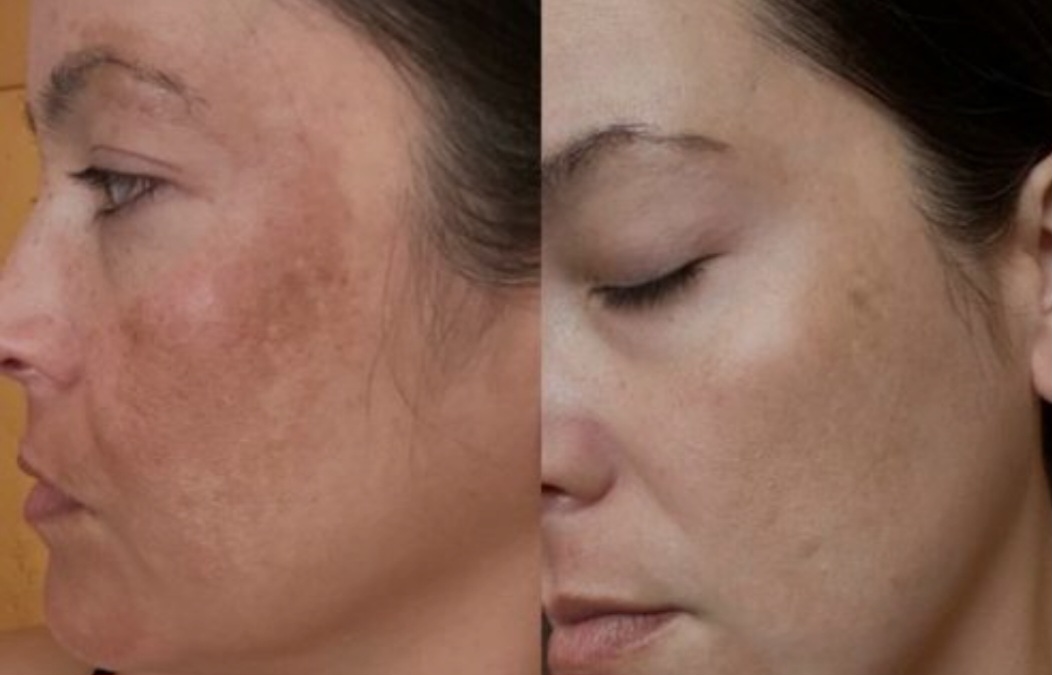 Rekomendasi sunscreen dengan kandungan Vitamin C