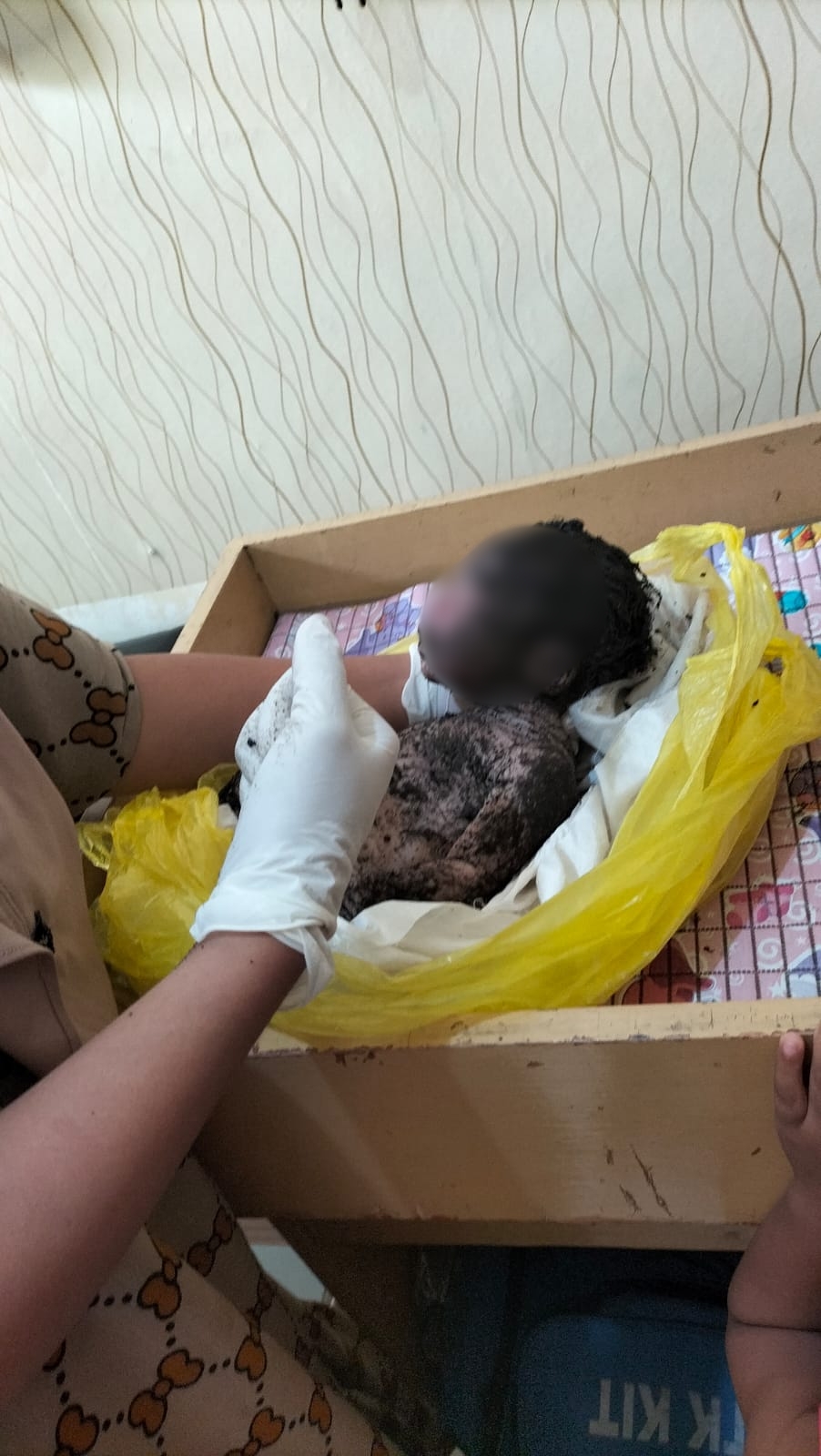 Kondisi mayat bayi laki-laki yang diduga sengaja dibuang