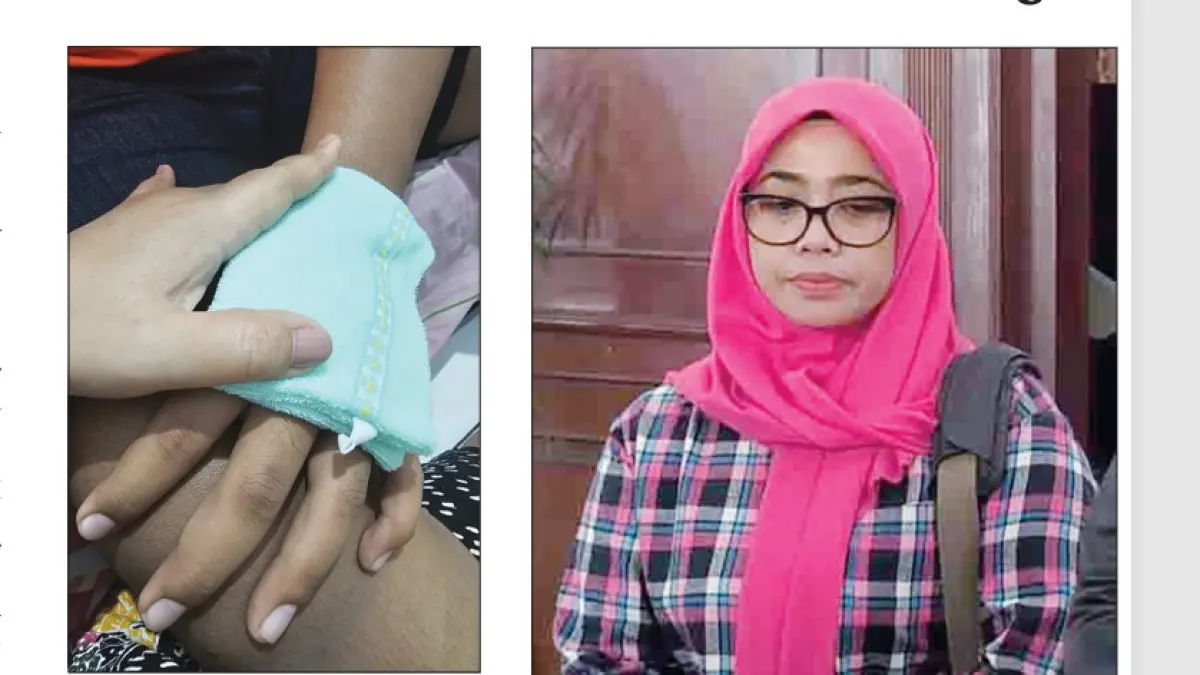 PROSES PEMULIHAN: Luka di tangan DFH akibat peluru nyasar. Foto kanan, ibunda korban, Dewi Murniati. (JAWA POS)