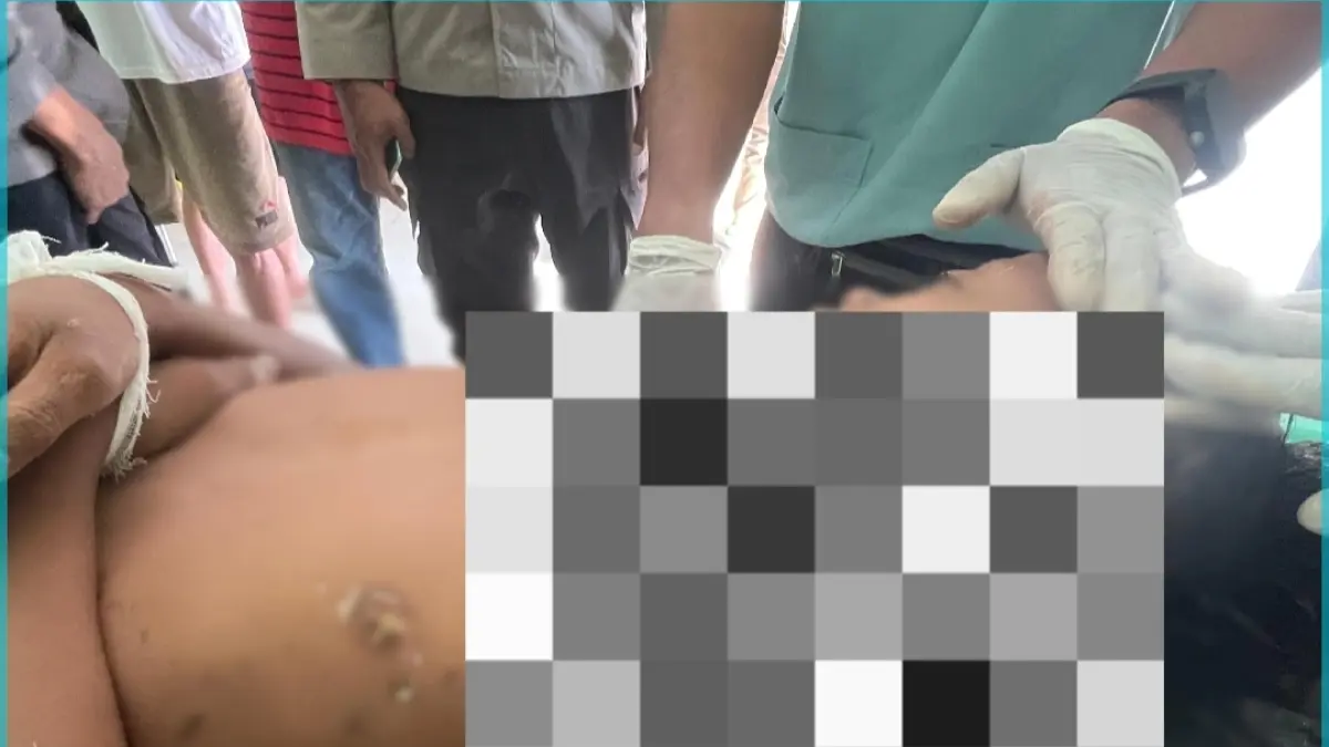 RJ, bocah 11 tahun asal Dusun Presak Mertak Bireng, Desa Semaya, Kecamatan Sikur, Lombok Timur tewas digigit anjing liar, Senin (13/4).