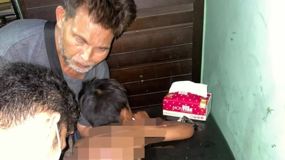 DITANGANI MEDIS: Korban gigitan anjing liar saat ditangani tim medis puskesmas setempat.