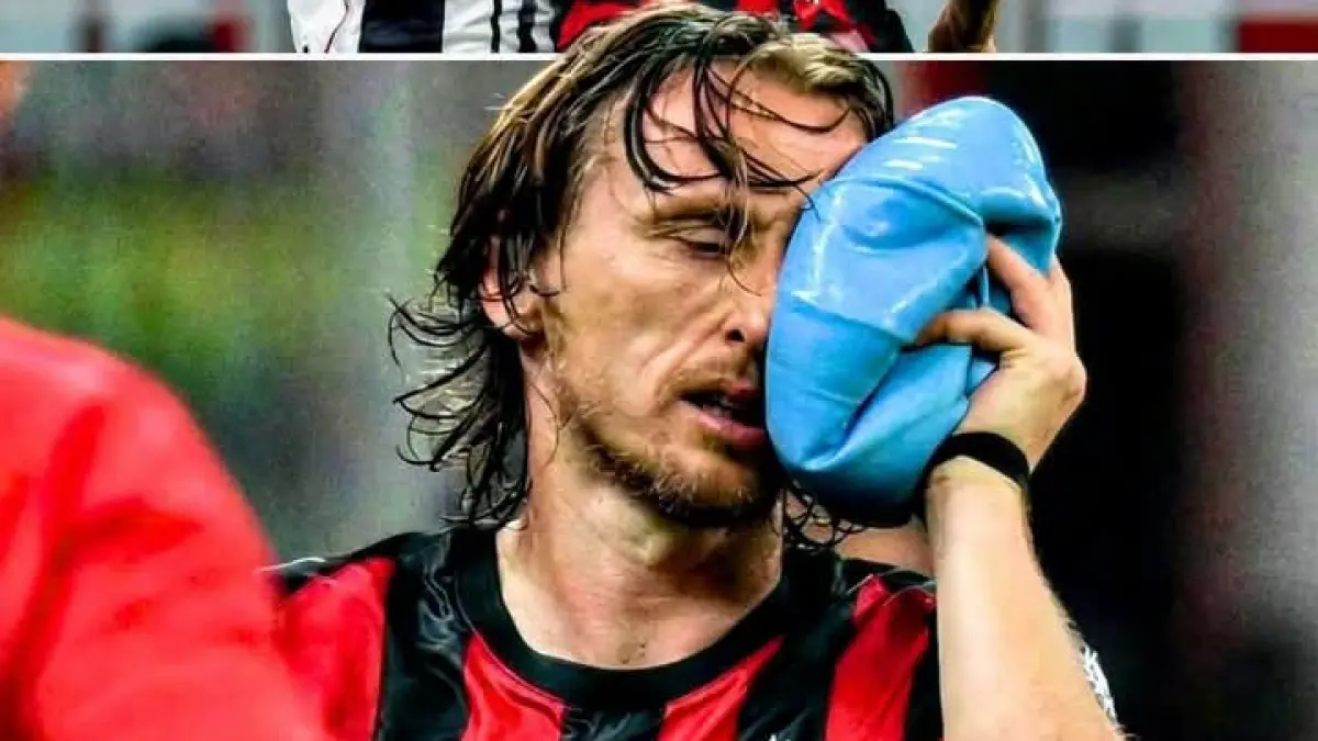 Gelandang AC Milan Luka Modric merasakan sakit di wajahnya setelah berbenturan dengan pemain Juventus, beberapa waktu lalu. (Istimewa) 