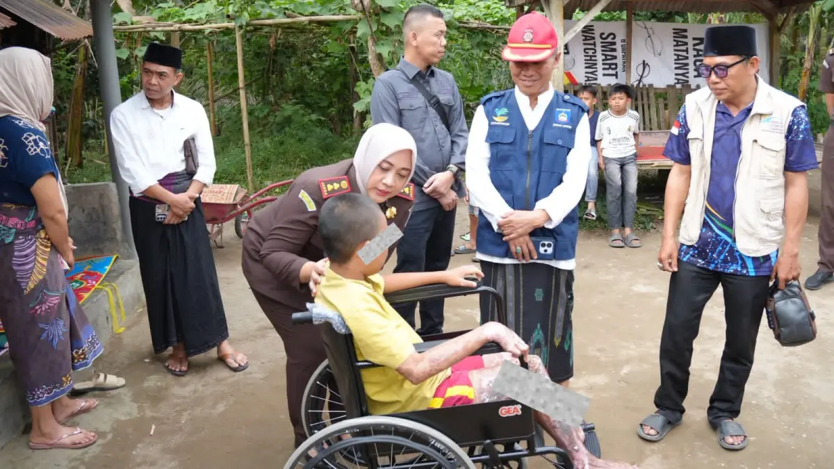 Kejari Loteng Putri Ayu Wulandari bersama Dinsos Loteng bergerak cepat menyalurkan bantuan sosial kepada seorang santri yang menjadi korban luka bakar di pondok pesantren di Kecamatan Batukliang. 
