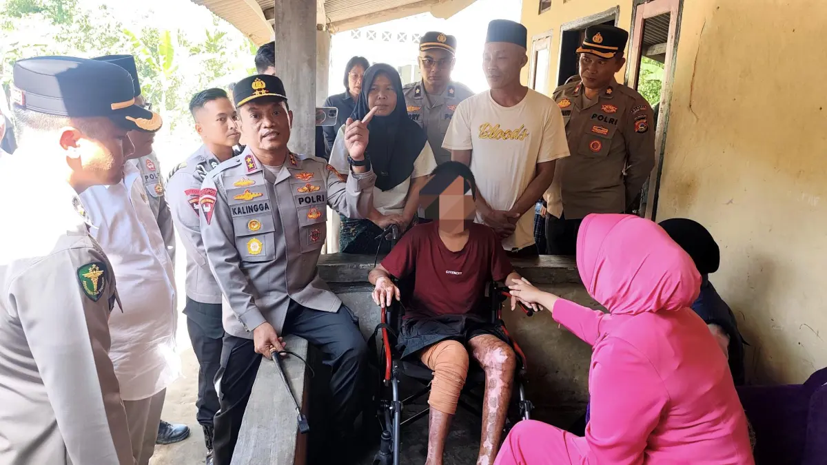 Kapolda NTB Irjen Pol. Kalingga Rendra Raharja (kiri) bersama Ketua Bhayangkari NTB Widhy Kalingga (kanan) menjenguk dan membawa SAH untuk mendapat perawatan lebih lanjut ke RS Bhayangkara saat berkunjung ke Desa Setiling, Batukliang Utara, Loteng, Selasa (7/7).