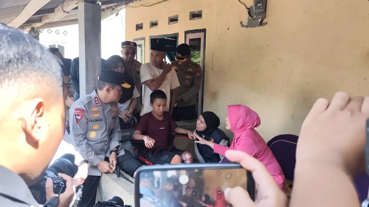 BERIKAN PERAWATAN: Kapolda NTB menjenguk santri yang masih menjalani perawatan akibat dari korban pembakaran di salah satu Ponpes di Lombok Tengah, Selasa (7/7) lalu. (DEWI LOMBOK POST)