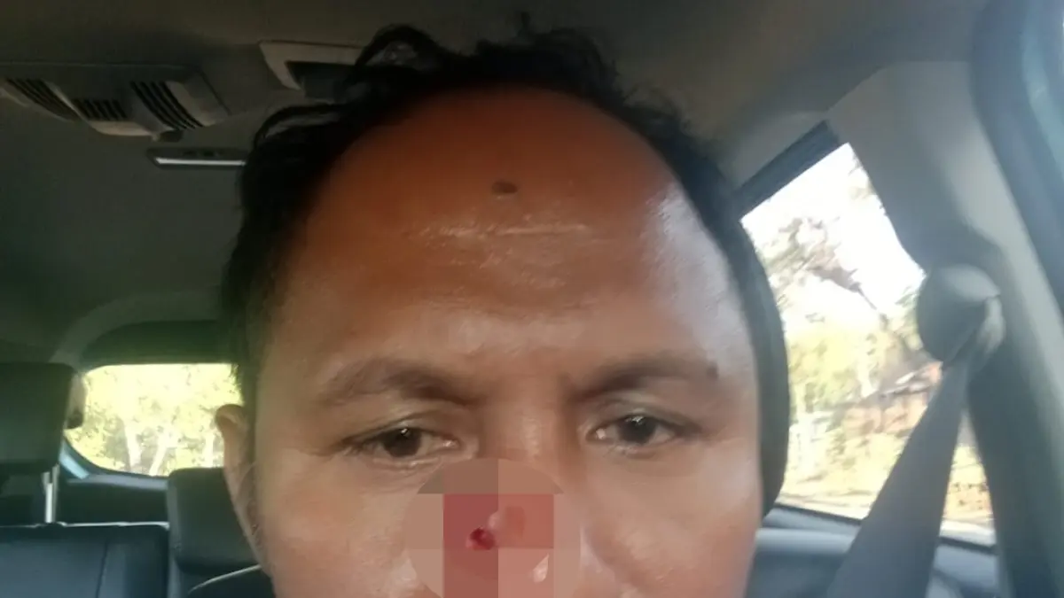 HIDUNG BERDARAH AKIBAT BENDA TUMPUL: Sopir Ridwan memperlihatkan wajahnya usai dipukul benda tumpul oleh oknum di Mandalika, akhir pekan lalu. (IST)