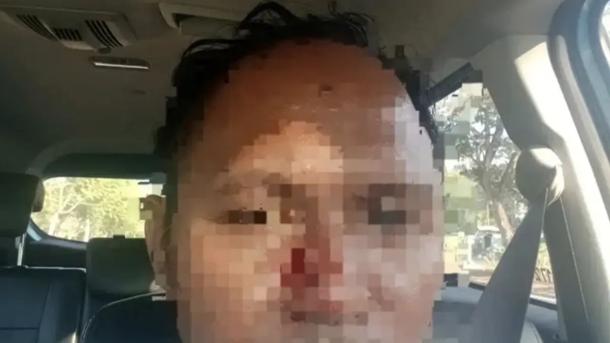 Kasus dugaan penganiayaan menimpa seorang sopir swasta di kawasan wisata Kuta, Lombok Tengah, Minggu (12/7). 