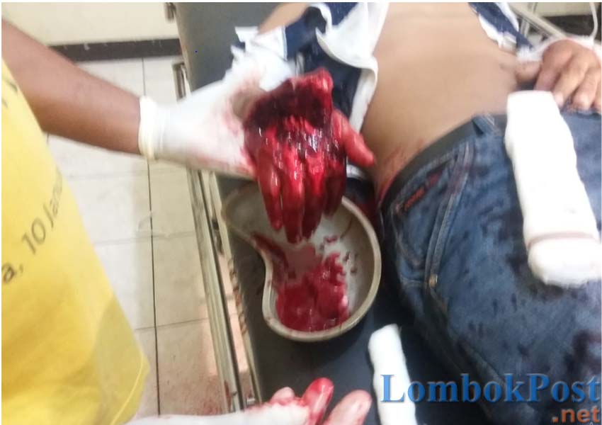 KORBAN: Seorang perawat tengah membersihkan luka di tangan Abidin, warga Dusun Pali Sondo, Desa Sondosia yang menjadi korban pembacokan
