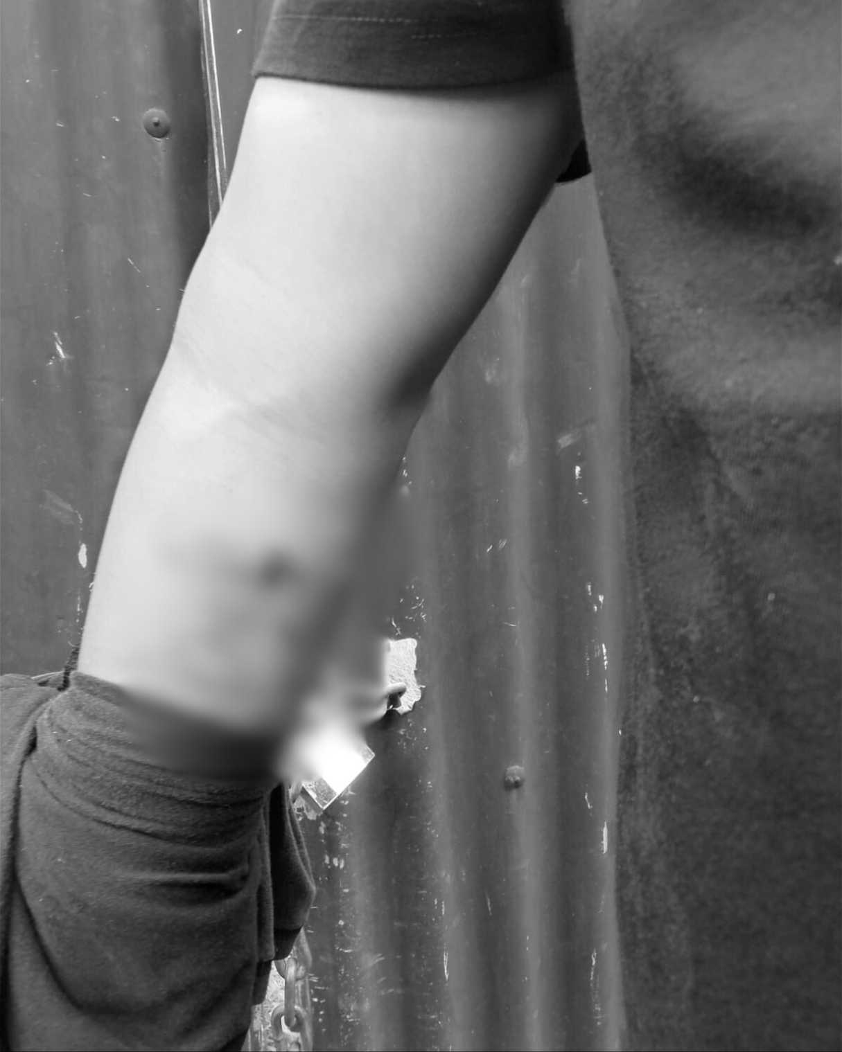 Tangan korban tampak terluka setelah tertembak.