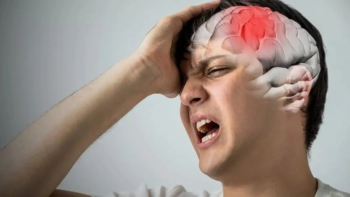 Ilustrasi remaja yang mengalami sakit kepala yang berlebihan merupakan tanda awal gejala stroke. (pinterest.com)