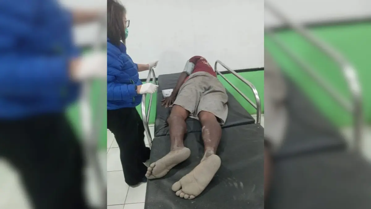 Salah satu korban dari masyarakat sipil yang dievakuasi ke RSUD Sugapa, Intan Jaya, Kamis (18/6/2026). (CEPOSONLINE.COM/Bupati Intan Jaya for Cepos)