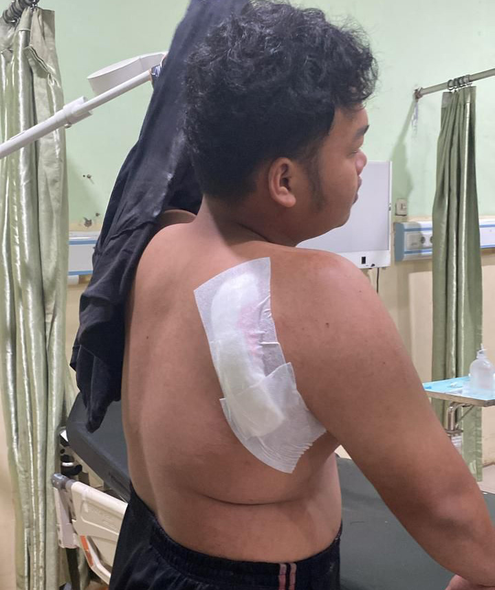 DIPERBAN: MS (17) korban pembacokan diduga dilakukan gangster di RTH Guntung Paikat, Senin (4/12) malam.
