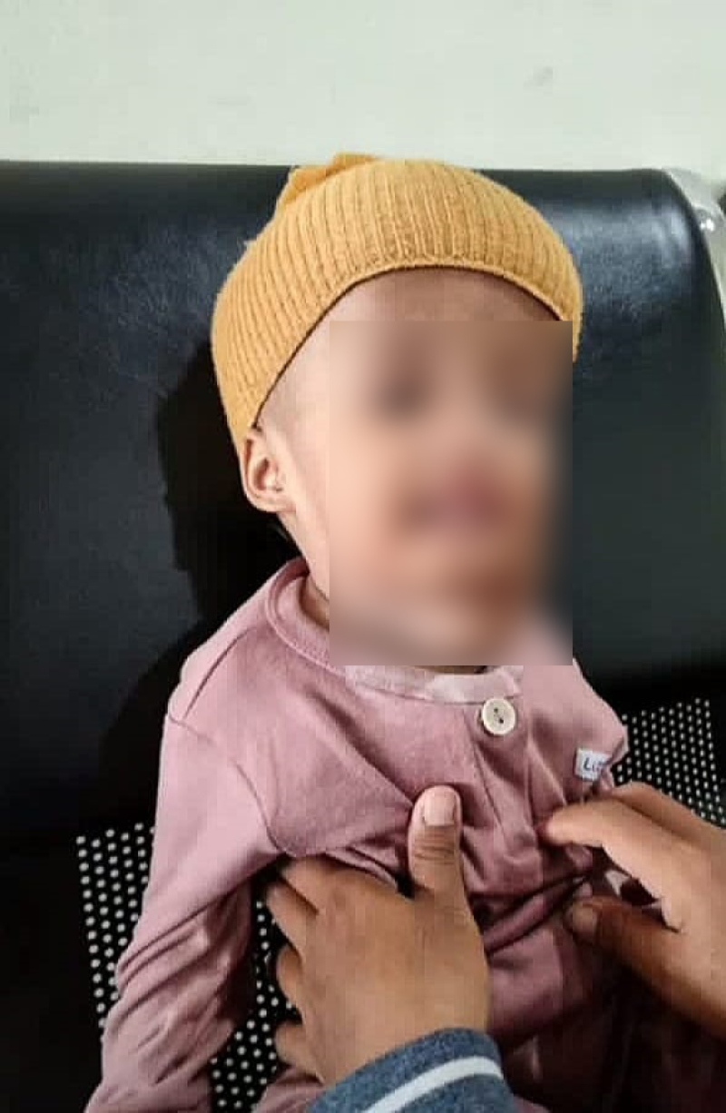 MELAWAN PENYAKIT: Putri Aisyah Septiani harus berjuang melawan segala penyakitnya untuk bertahan hidup.