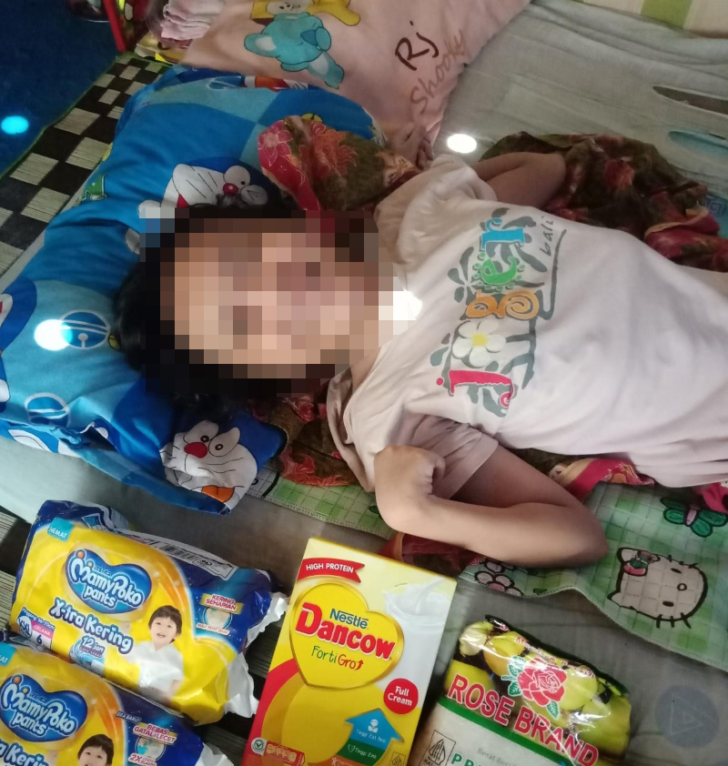 TERBARING: Syabania Jauza, warga Kelurahan Bangkal, Kecamatan Cempaka, yang menderita Cerebal Palsy atau kelumpuhan otak.
