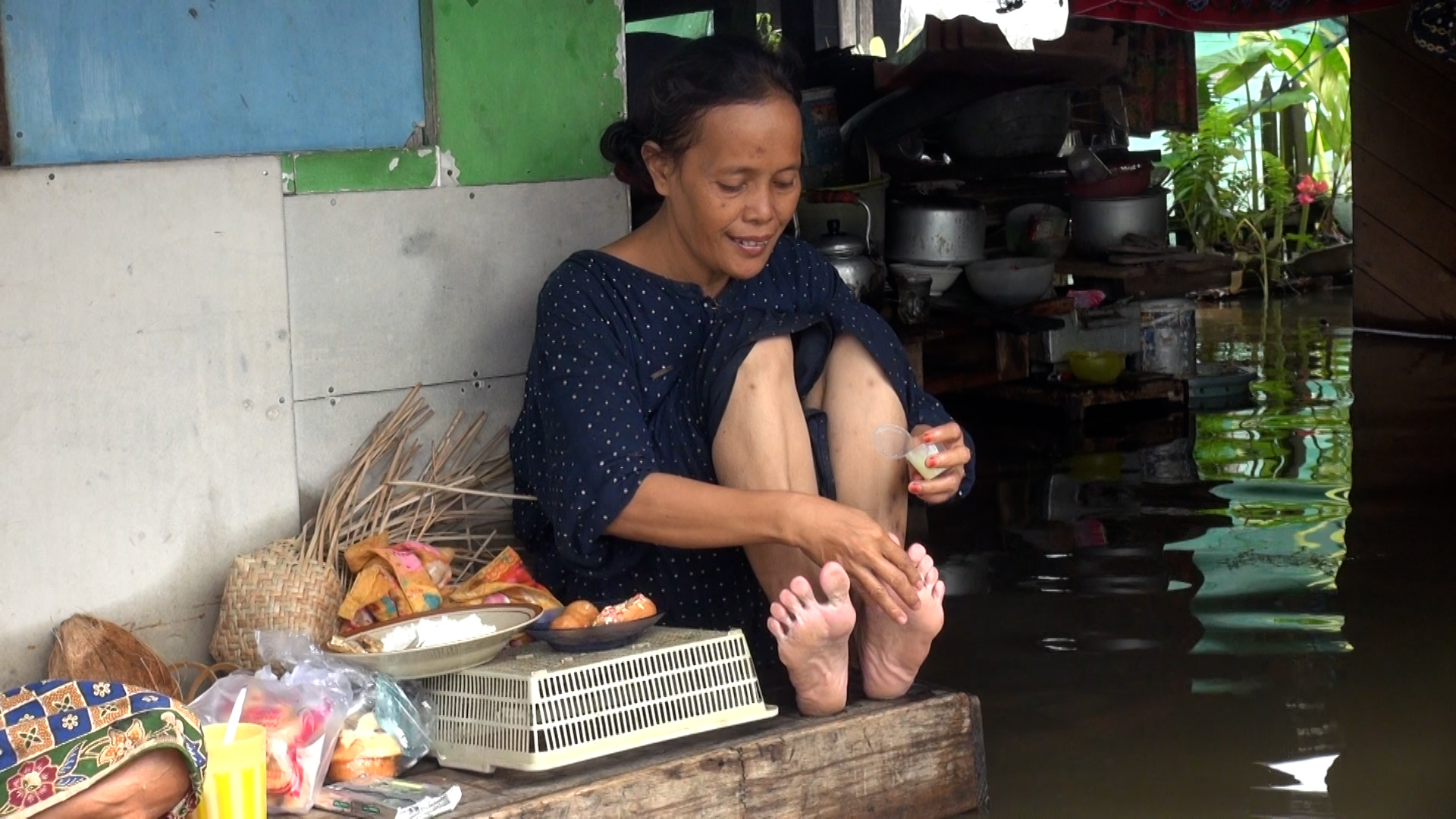 DAMPAK BANJIR: Kondisi kaki warga yang terserang kutu air alias lancat akibat terlalu sering terendam air banjir.